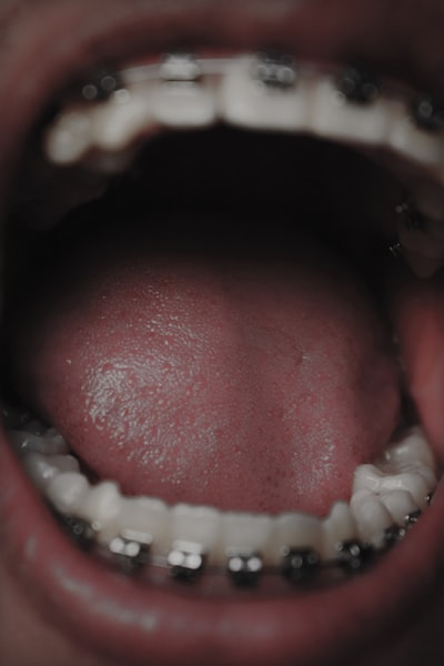 Oral-B Pro 1000