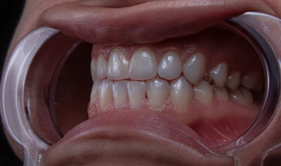 Oral-B Pro 2000