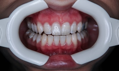 Oral-B Pro 5000