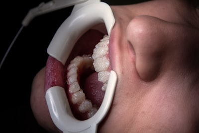 Oral-B Smart 1500