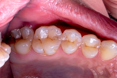 Oral-B iO Series 9